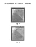 AUTOMATED IDENTIFICATION OF AN ANATOMY PART diagram and image