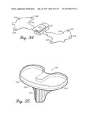 DISTRACTOR HAVING A CAPACITIVE SENSOR ARRAY FOR MEASURING A FORCE,     PRESSURE, OR LOAD APPLIED BY THE MUSCULAR-SKELETAL SYSTEM AND METHOD     THEREFOR diagram and image