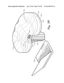 DISTRACTOR HAVING AN INTERNAL LOAD MEASURMENT SYSTEM FOR THE     MUSCULAR-SKELETAL SYSTEM AND METHOD THEREFOR diagram and image