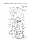 DISTRACTOR HAVING AN INTERNAL LOAD MEASURMENT SYSTEM FOR THE     MUSCULAR-SKELETAL SYSTEM AND METHOD THEREFOR diagram and image