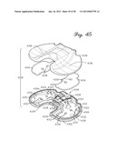 DISTRACTOR HAVING AN INTERNAL LOAD MEASURMENT SYSTEM FOR THE     MUSCULAR-SKELETAL SYSTEM AND METHOD THEREFOR diagram and image