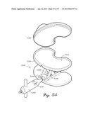 DISTRACTOR HAVING AN INTERNAL LOAD MEASURMENT SYSTEM FOR THE     MUSCULAR-SKELETAL SYSTEM AND METHOD THEREFOR diagram and image