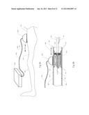 Devices and Methods for Endovascular Therapies diagram and image