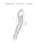 SUTURE SYSTEM WITH CAPSULE EYELET PROVIDING MULTIPLE SUTURE TISSUE     FIXATION diagram and image