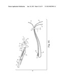 SUTURE SYSTEM WITH CAPSULE EYELET PROVIDING MULTIPLE SUTURE TISSUE     FIXATION diagram and image