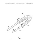 Method for Tissue Fixation diagram and image