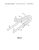 Method for Tissue Fixation diagram and image