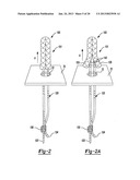 Method for Tissue Fixation diagram and image