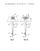 Method for Tissue Fixation diagram and image