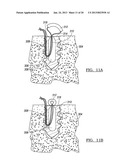 Method for Tissue Fixation diagram and image