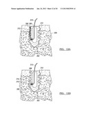 Method for Tissue Fixation diagram and image