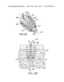 Method for Tissue Fixation diagram and image