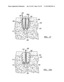 Method for Tissue Fixation diagram and image