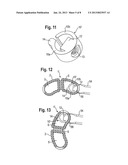 INTERVERTEBRAL IMPLANT diagram and image