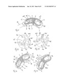 INTERVERTEBRAL IMPLANT diagram and image