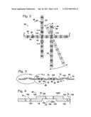 BONE FIXATION WITH OVERLAPPING BONE PLATES diagram and image