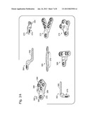 BONE FIXATION WITH OVERLAPPING BONE PLATES diagram and image