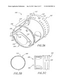 METHOD FOR TREATING AN AORTIC VALVE diagram and image