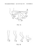 SYSTEMS AND METHODS FOR PROVIDING DEEPER KNEE FLEXION CAPABILITIES FOR     KNEE PROSTHESIS PATIENTS diagram and image