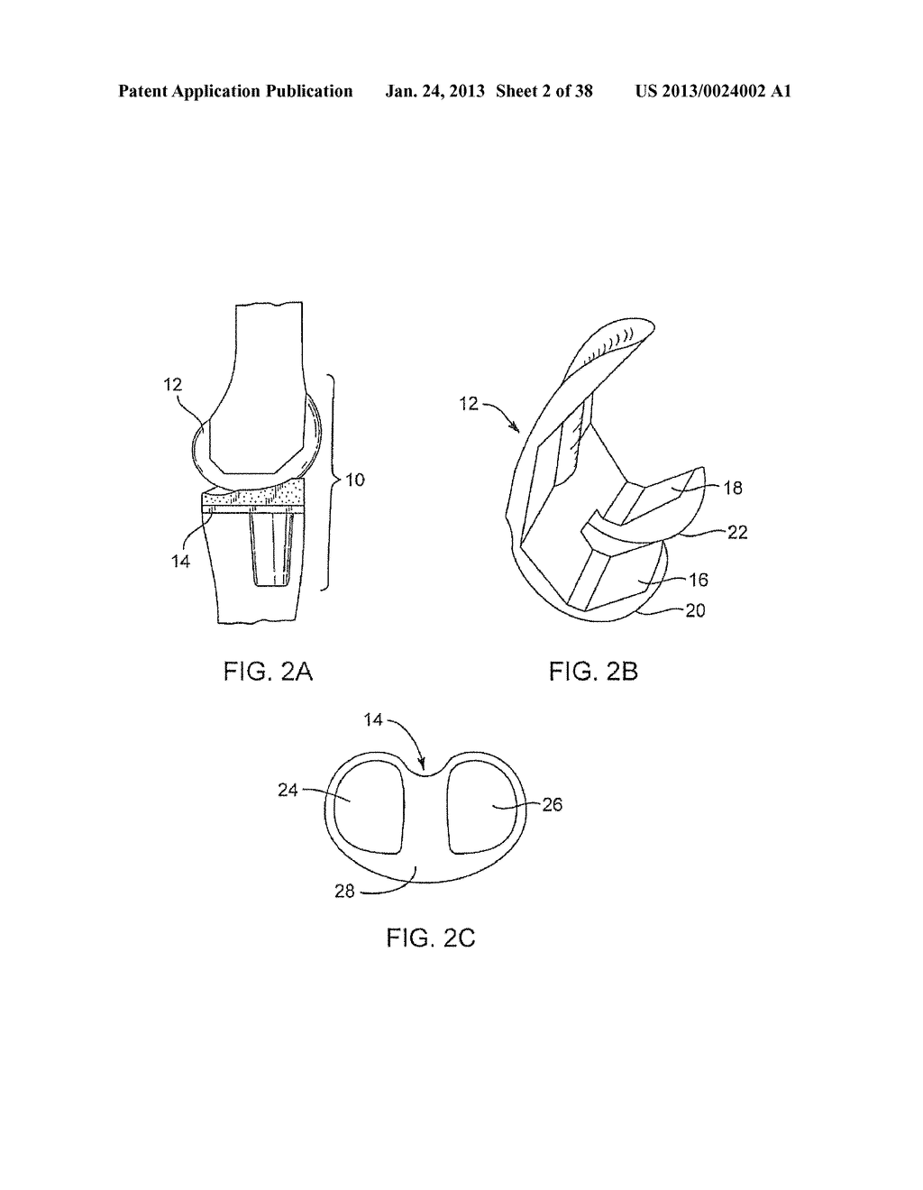 SYSTEMS AND METHODS FOR PROVIDING DEEPER KNEE FLEXION CAPABILITIES FOR     KNEE PROSTHESIS PATIENTS - diagram, schematic, and image 03