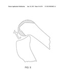 SYSTEMS AND METHODS FOR PROVIDING DEEPER KNEE FLEXION CAPABILITIES FOR     KNEE PROSTHESIS PATIENTS diagram and image