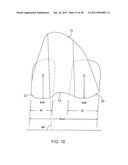 SYSTEMS AND METHODS FOR PROVIDING DEEPER KNEE FLEXION CAPABILITIES FOR     KNEE PROSTHESIS PATIENTS diagram and image