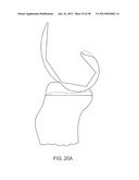 SYSTEMS AND METHODS FOR PROVIDING DEEPER KNEE FLEXION CAPABILITIES FOR     KNEE PROSTHESIS PATIENTS diagram and image