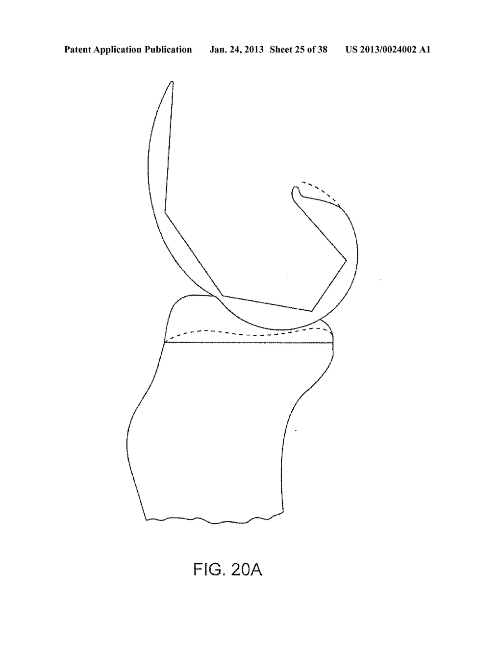 SYSTEMS AND METHODS FOR PROVIDING DEEPER KNEE FLEXION CAPABILITIES FOR     KNEE PROSTHESIS PATIENTS - diagram, schematic, and image 26