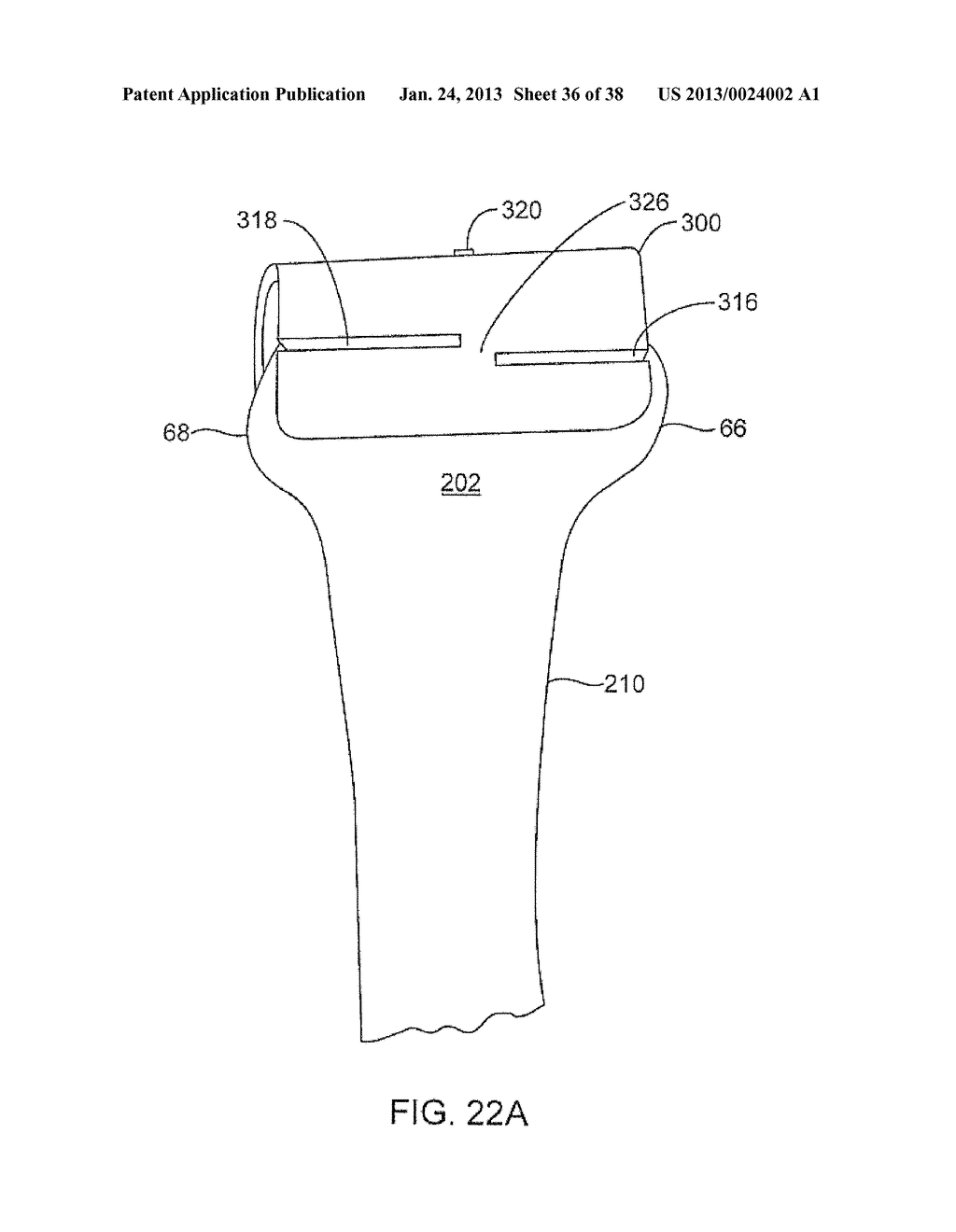 SYSTEMS AND METHODS FOR PROVIDING DEEPER KNEE FLEXION CAPABILITIES FOR     KNEE PROSTHESIS PATIENTS - diagram, schematic, and image 37