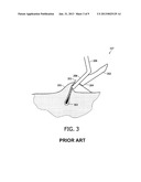 CUTTING UNIT WITH GUARD TEETH AND HAIR-CUTTING DEVICE diagram and image