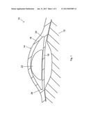 HOOD ASSEMBLY FOR USE WITH A PROTECTIVE SUIT diagram and image