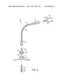 TRACHEAL TUBE WITH REINFORCED PROXIMAL EXTENSION diagram and image