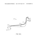 Protecting A Fluid Stream From Fouling diagram and image