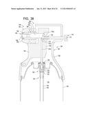 Systems and Methods for Dispensing Texture Material Using Dual Flow     Adjustment diagram and image