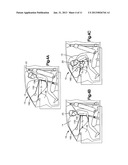 AIR BAG WITH VARIABLE VENTING diagram and image