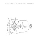 AIR BAG WITH VARIABLE VENTING diagram and image