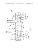 Forward mount diagram and image