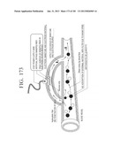 TUBE-STRUCTURED BATTERY TO BE INSERTED INTO LIVING BODY diagram and image