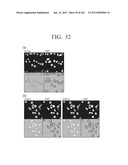 TUBE-STRUCTURED BATTERY TO BE INSERTED INTO LIVING BODY diagram and image