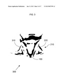 ANATOMICAL RECOGNITION, ORIENTATION AND DISPLAY OF AN UPPER TORSO TO     ASSIST BREAST SURGERY diagram and image