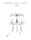 ANATOMICAL RECOGNITION, ORIENTATION AND DISPLAY OF AN UPPER TORSO TO     ASSIST BREAST SURGERY diagram and image