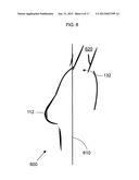 ANATOMICAL RECOGNITION, ORIENTATION AND DISPLAY OF AN UPPER TORSO TO     ASSIST BREAST SURGERY diagram and image