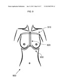 ANATOMICAL RECOGNITION, ORIENTATION AND DISPLAY OF AN UPPER TORSO TO     ASSIST BREAST SURGERY diagram and image