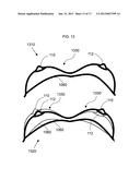 ANATOMICAL RECOGNITION, ORIENTATION AND DISPLAY OF AN UPPER TORSO TO     ASSIST BREAST SURGERY diagram and image