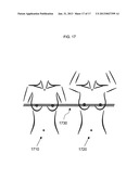 ANATOMICAL RECOGNITION, ORIENTATION AND DISPLAY OF AN UPPER TORSO TO     ASSIST BREAST SURGERY diagram and image