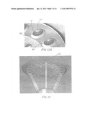 Light-Directing Apparatus with Protected Reflector-Shield and Lighting     Fixture Utilizing Same diagram and image