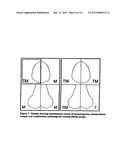 IMAGE HANDLING AND DISPLAY IN X-RAY MAMMOGRAPHY AND TOMOSYNTHESIS diagram and image