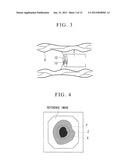 FLUOROSCOPY DEVICE diagram and image