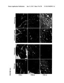 TWEAK/FN14 SYSTEM REGULATES SKELETAL MUSCLE ATROPHY AND REGENERATION diagram and image