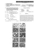 TLR 4 AND 9 RECEPTORS AGONISTS FOR PREVENTING SEPTIC COMPLICATIONS OF     POST-TRAUMATIC IMMUNODEPRESSION IN PATIENTS HOSPITALIZED FOR SEVERE     TRAUMATIC INJURIES diagram and image